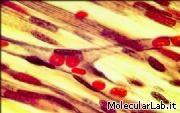 Globuli rossi in un capillare