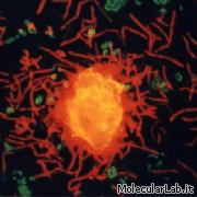 Colonie Rhodococcus attorno cristallo di silicato