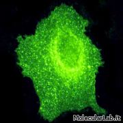 Cellula HeLa con GFP