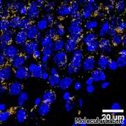 Nanoparticelle contro la beta-amiloide d'Alzhe