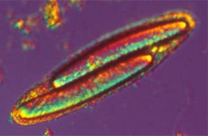 Eccolo qui! Questo batterio - come di norma tutti i batteri - non ha organelli: quei due affari sono nient'altro che due nuovi "piccoli" batteri che stanno crescendo all'interno della cellula madre. Un'altro motivo per il quale è stato scambiato per un protista per molto tempo (anche se è dieci volte più grosso, comunque...). Fonte:cals.cornell.edu