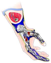 http://www.molecularlab.it/public/news/_20051231_mano_robot_protesi.jpg