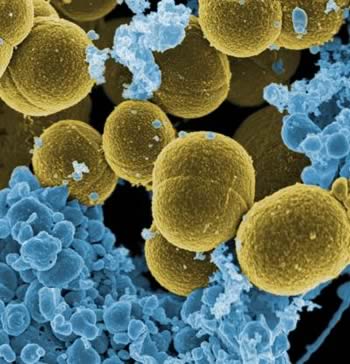 S. aureus