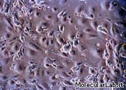 Hydrogel come supporto per la crescita di tessuti _20070705_cheratinociti_staminali_cellule