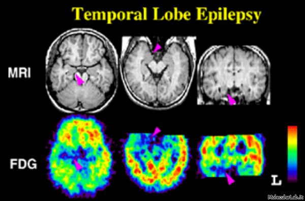 free Ancient Bloodlines