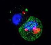 Cellula staminale normale in divisione asimmetrica