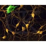Neuroni