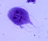 Giardia Intestinalis