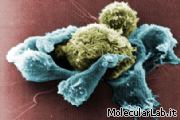 Linfociti T killer contro cellula cancerosa