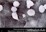 Formazion placca ateroscletorica:adesione monociti