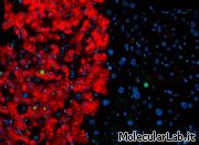 Fibroblasti trasformati in iPS e poi cellule fegat