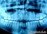 Radiografia raggi X di una bocca