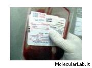 sangue