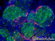 Staminali convertite in cellule beta del pancreas