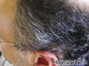 Capelli bianchi