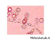 Candida albicans