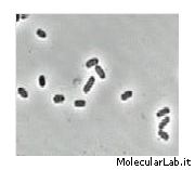 Escherichia coli