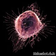 Cellula cancerogena