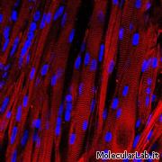 Fibre muscolari striate
