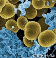 Staphylococcus aureus