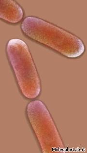 listeri monocytogenes