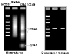 Northern Blot