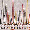 Prioni