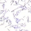 Clostridium tetani