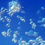 Cellule staminali