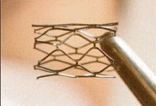 Stent
