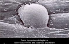 Placca aterosclerotica: adesione monocita
