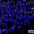 Sviluppate nanoparticelle contro Alzheimer