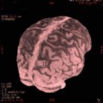 Ricostruzione 3D di una tomografia al cervello