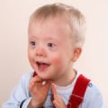 Bambino con sindrome di Down
